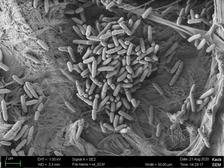 Bacteria Pseudomonas aeruginosa